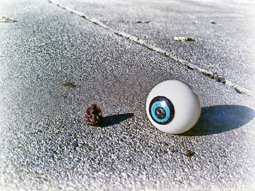 My Eyeball Gets A surprise Visit by hbmike2000