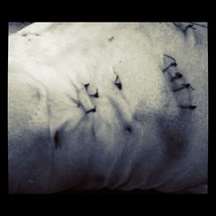 week 31 (sutures!)