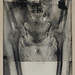 X-ray of Neshkons' Mummy (Part of the Merrin Sarcophagus)