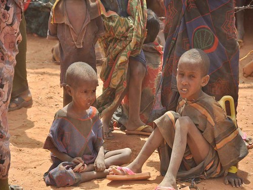 Malnourished children, weakened by hunger