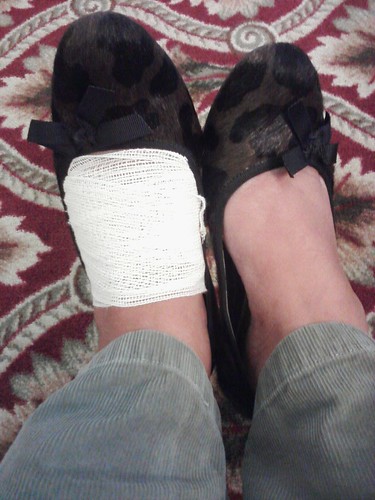 My injured foot wrapped in gauze for cushion. Self-applied.