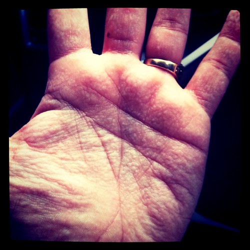 These are my hands after 5 minutes of water... I'm all f'ed up inside... by Bracuta
