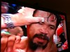 Manny Pacquiao all busted, during one of the fights intervals... / Manny com cara arrebentada durante um dos intervalos...