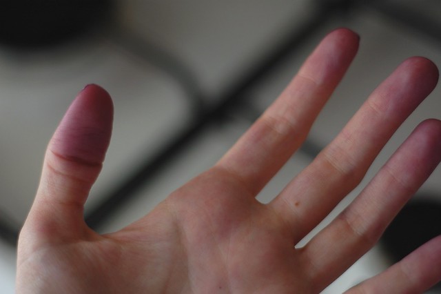 purple fingers
