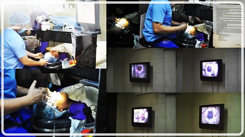 During the lasik surgery