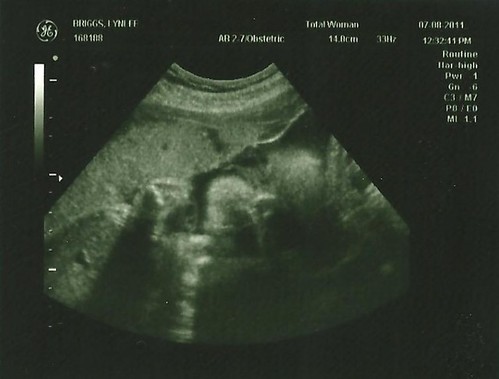 30 week ultrasound 2