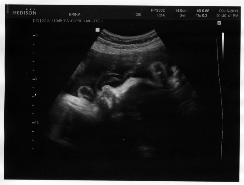 BABY 6 ultrasound 9-15-2011-800