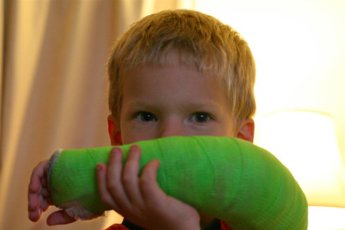 "Take a picture of my cast!"