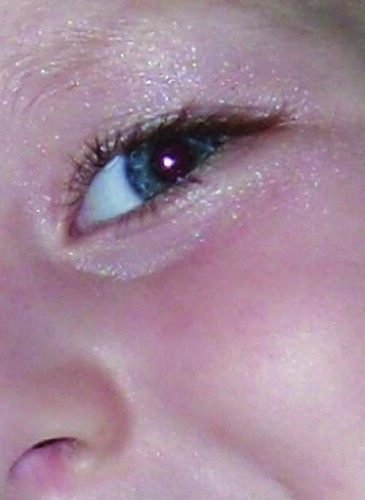 cousin's eye photo