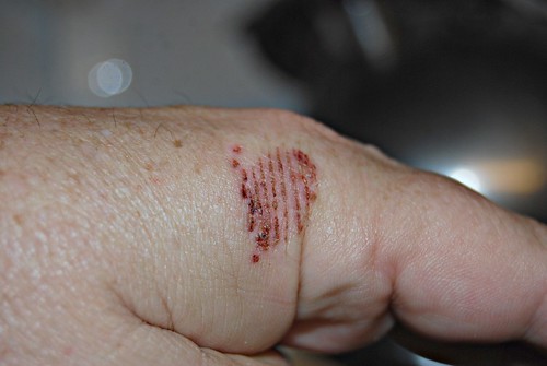 abrasion definition/meaning | English picture dictionary Imagict