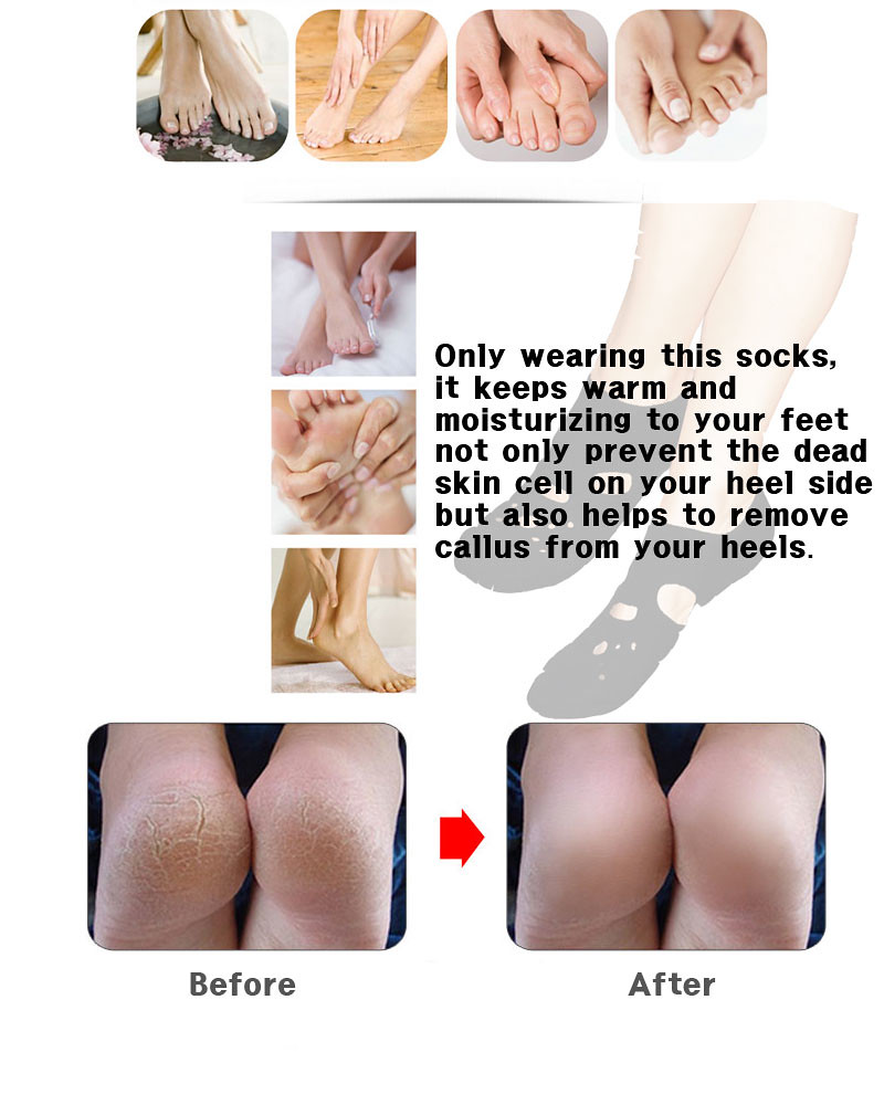 Unisex Neoprene Foot Care Outer Warm Retain Socks Warmer Heel Crack Callus Fissu