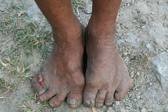 Some well used feet ! on the Kameng river Adventure rafting and Kayaking trip