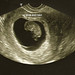ultrasound-1_ed