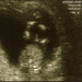 ultrasound-2_ed