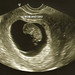 ultrasound-0_ed