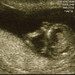 ultrasound-4_ed