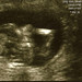 ultrasound-3_ed